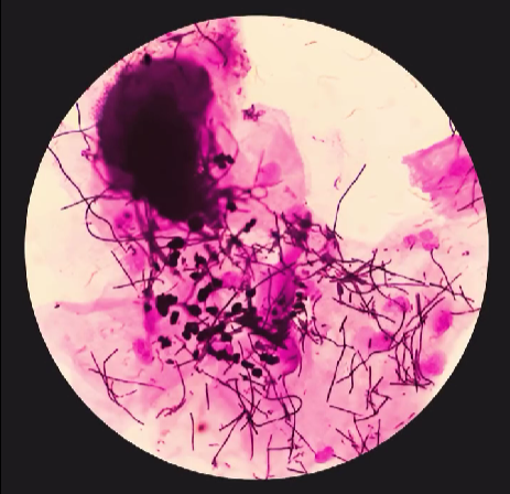 🖤 Persönliche Kunstdrucke (Abstrich-Service)